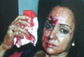 Car Accident: Hema Malinis Driver Arrested.